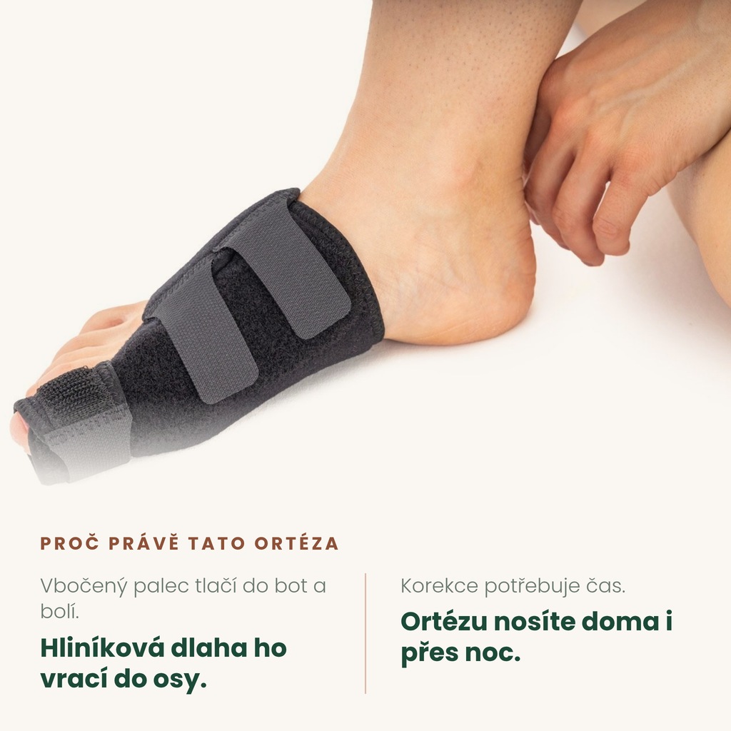 Ortéza na hallux valgus REH4MAT – dlaha vrací palec do osy