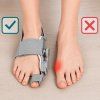 Korektor vbočeného palce hallux valgus 2