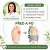 Korektor vbočeného palce hallux valgus 4