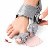Korektor vbočeného palce hallux valgus 1