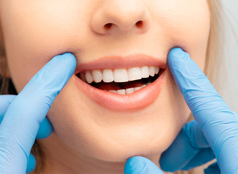 Zdrowe usta bez próchnicy: jak właściwa higiena wpływa na mikrobiom jamy ustnej?