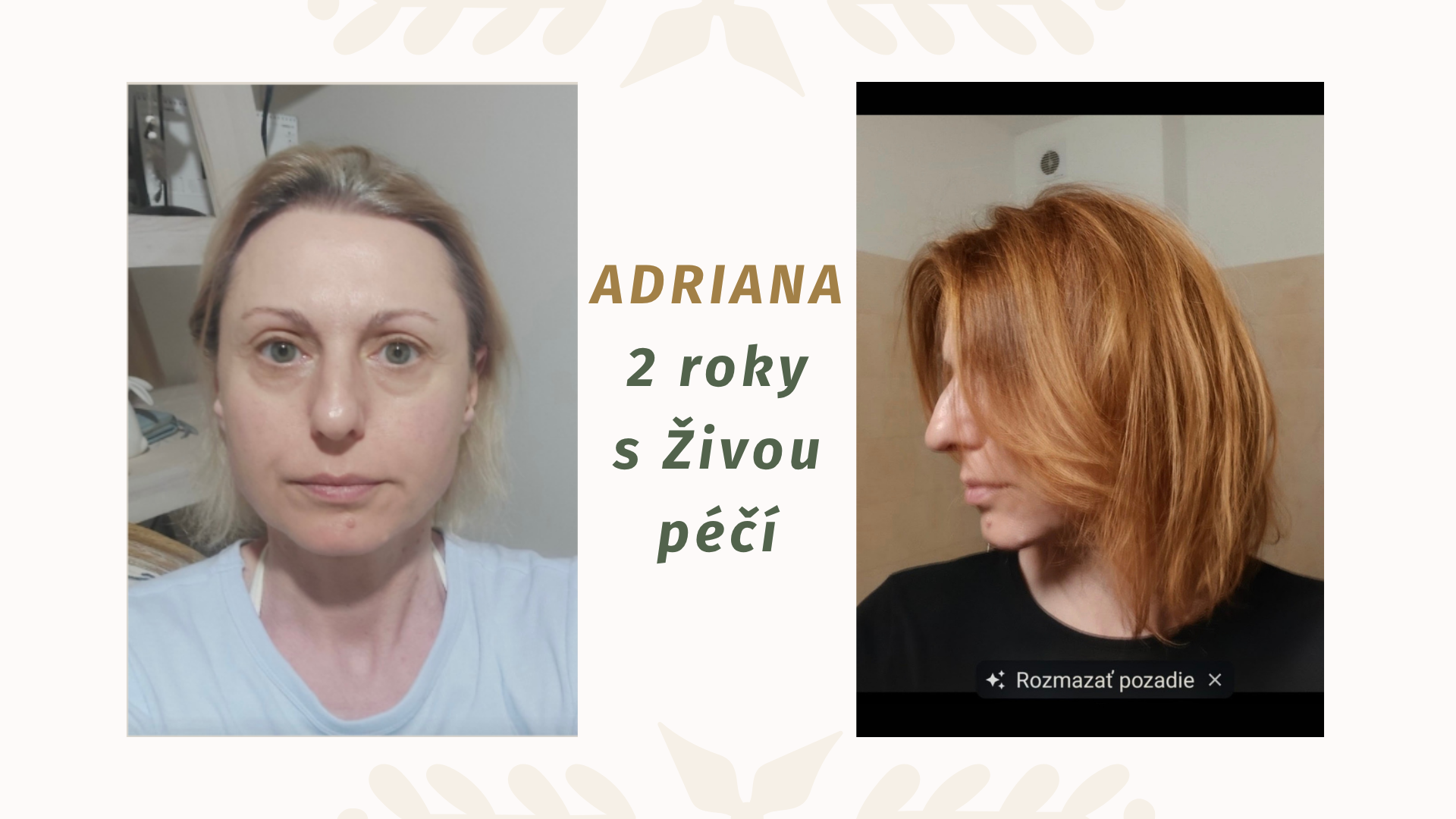 Jak začít se živou péčí — najděte svůj první krok