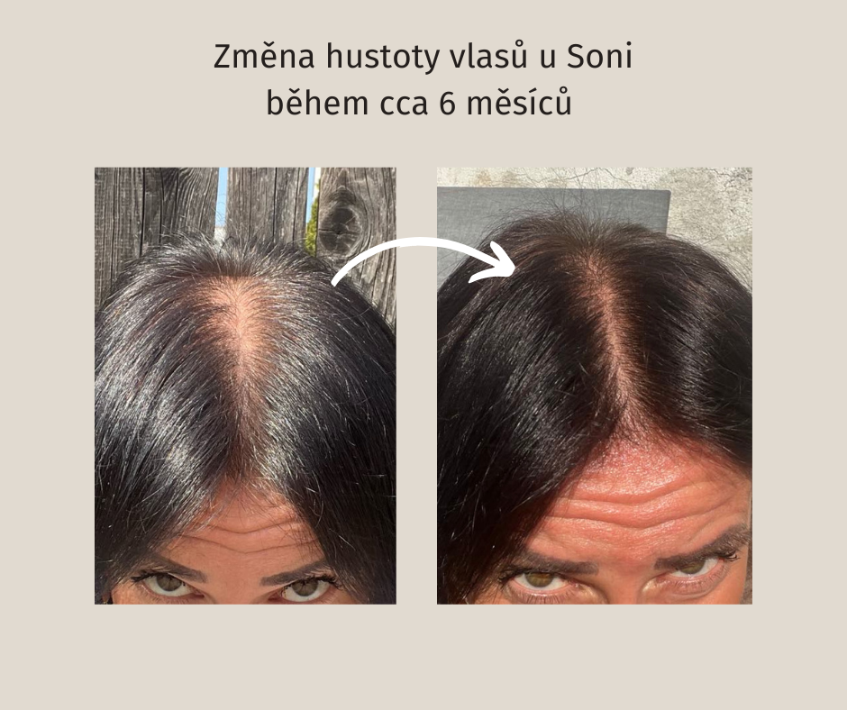 Takhle se Soně změnily vlasy za 6 měsíců