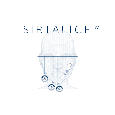 sirtalice