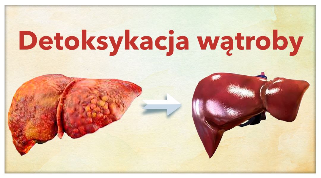 Detoksykacja