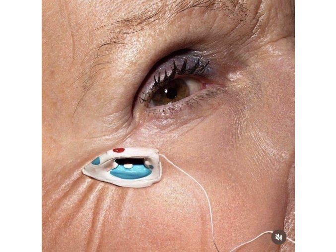 Retinoate 10% 10 ml