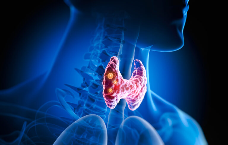 Štítná žláza