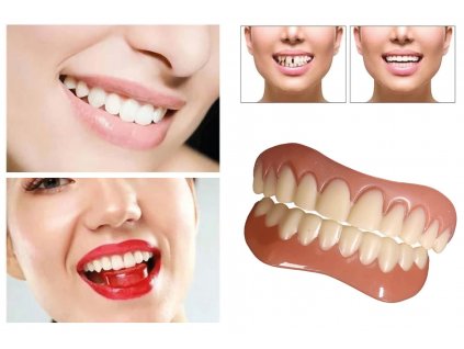 DVOJBALENIE - Dočasná snímateľná zubná náhrada - vrchná a spodná