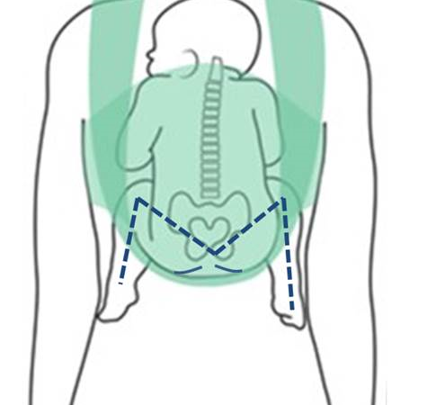 Stanovisko České pediatrické společnosti k nošení malých dětí v šátku či závěsu – tzv. „šátkování“ - pro a proti