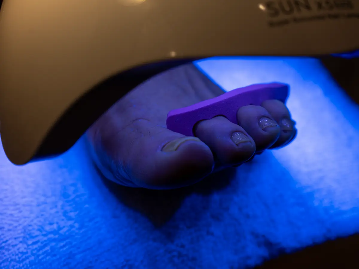 Ženská noha pod UV lampou