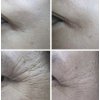 Dr. Melaheal - Postbiotics Cs Magic Ampule - Ampule s probiotiky proti stárnutí  pleti - 100 ml