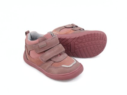 Protetika Banet Terakota