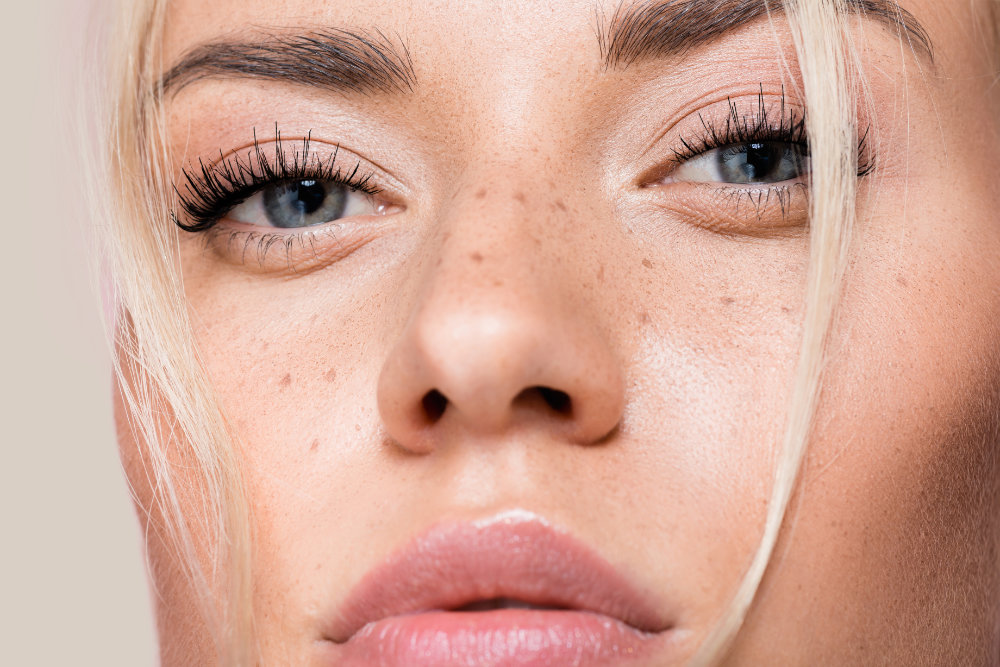 Súťaž o sérum - pred a po fotky