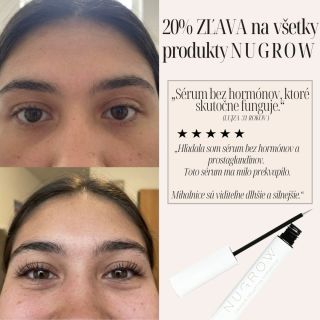 NUGROW je sérum na mihalnice bez hormónov a prostaglandínov, ktoré podporuje rast a zlepšuje kvalitu vašich prirodzených...