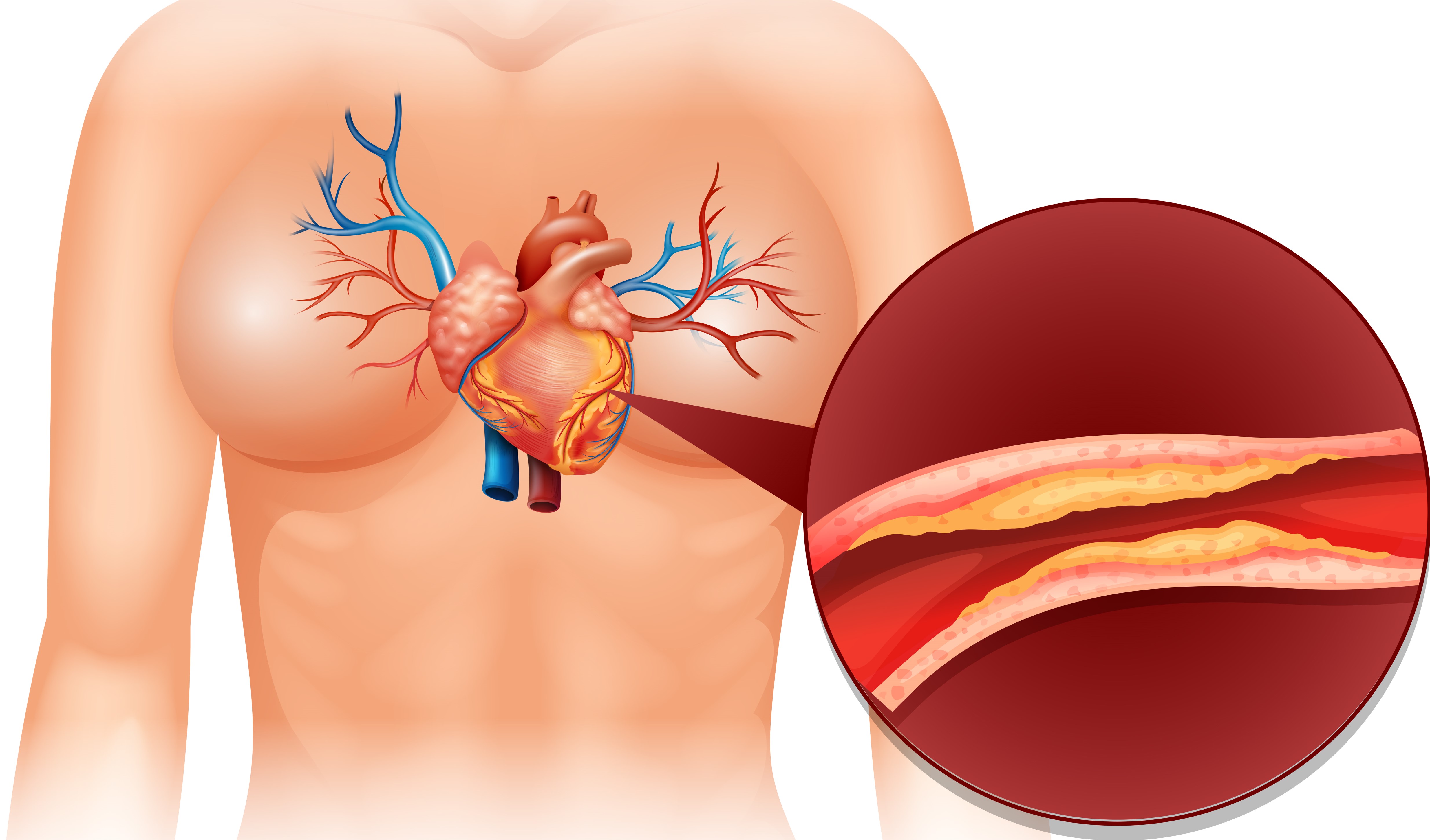 Cholesterol, imunita a pohybové aktivity