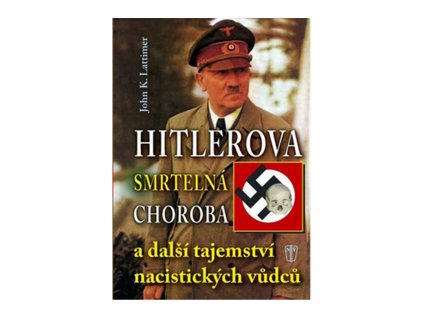 Hitlerova smrtelná choroba a další tajemství nacistických vůdců