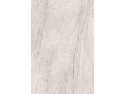 R155