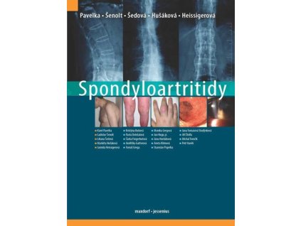 Spondyloartritidy