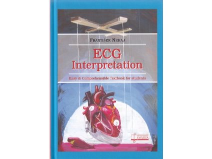 ECG Interpretation