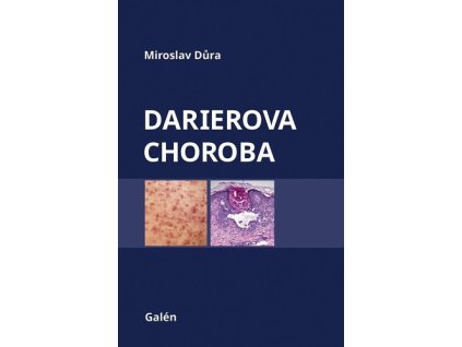 Darierova choroba