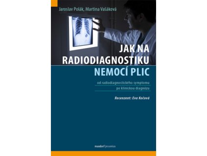 Jak na radiodiagnostiku nemocí plic