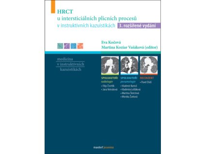 HRCT u intersticiálních plicních procesů v instruktivních kazuistikách