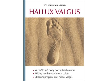 Hallux valgus