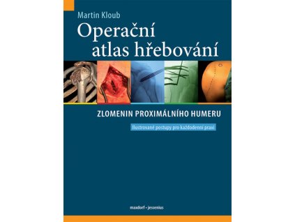 Operační atlas hřebování zlomenin proximálního humeru