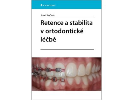 Retence a stabilita v ortodontické léčbě