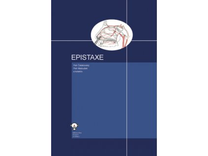 Epistaxe