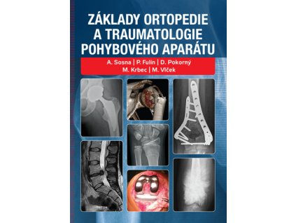 Základy ortopedie a traumatologie pohybového aparátu