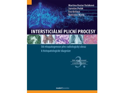 Intersticiální plicní procesy