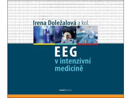 EEG v intenzivní medicíně