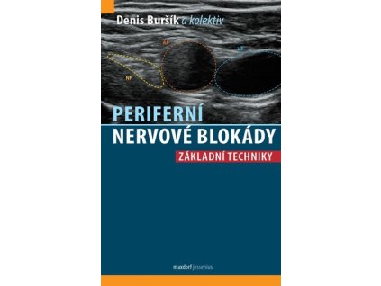 Periferní nervové blokády