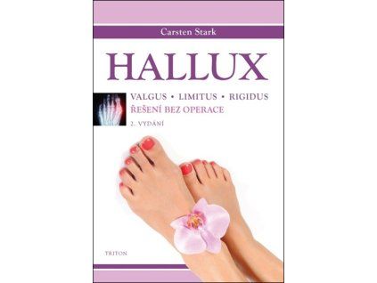 Hallux