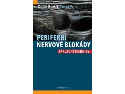 Periferní nervové blokády