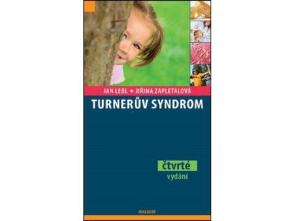 Turnerův syndrom
