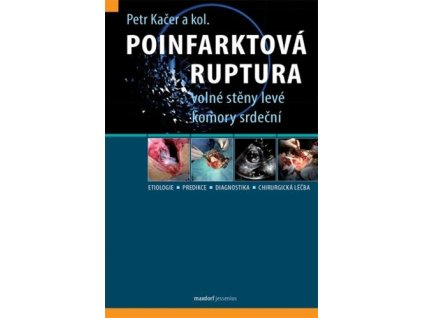 Poinfarktová ruptura