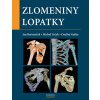 Zlomeniny lopatky