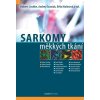 Sarkomy měkkých tkání