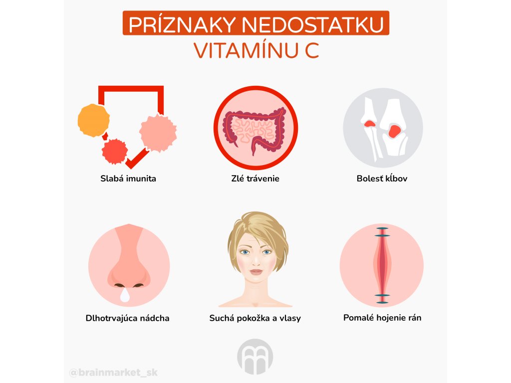 33835-2_priznaky-nedostatku-vitaminu-c-infografika-sk