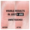 Neutrogena Krém na suchá chodidla 100 ml