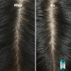 L'Oréal Professionnel Šampon proti lupům Scalp Advanced (Anti-Dandruff Dermo Clarifier Shampoo) (Objem 500 ml)