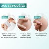 hydrokoloidni naplasti na nedokonalosti pure active pimple patch 22 ks 251488575124324
