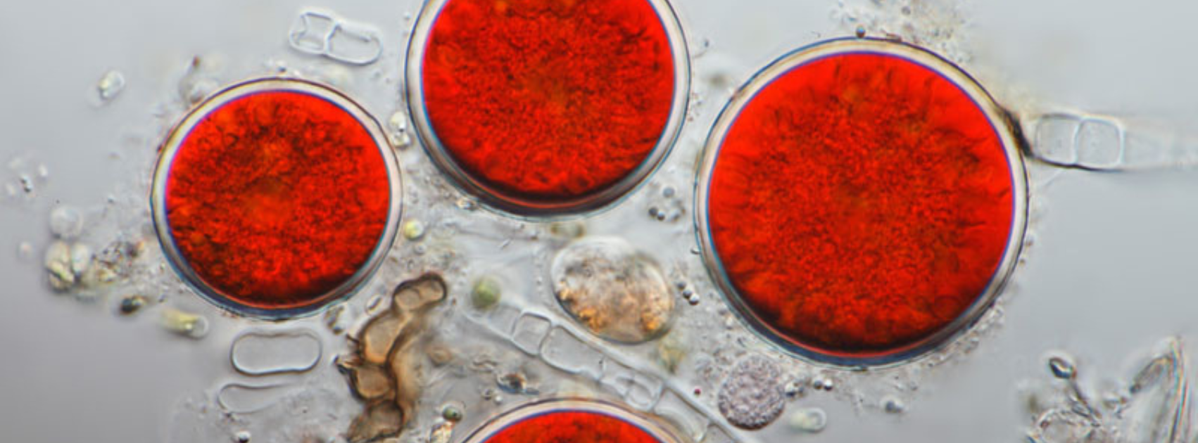 Mi az asztaxantin és hogyan segíti a bőrt