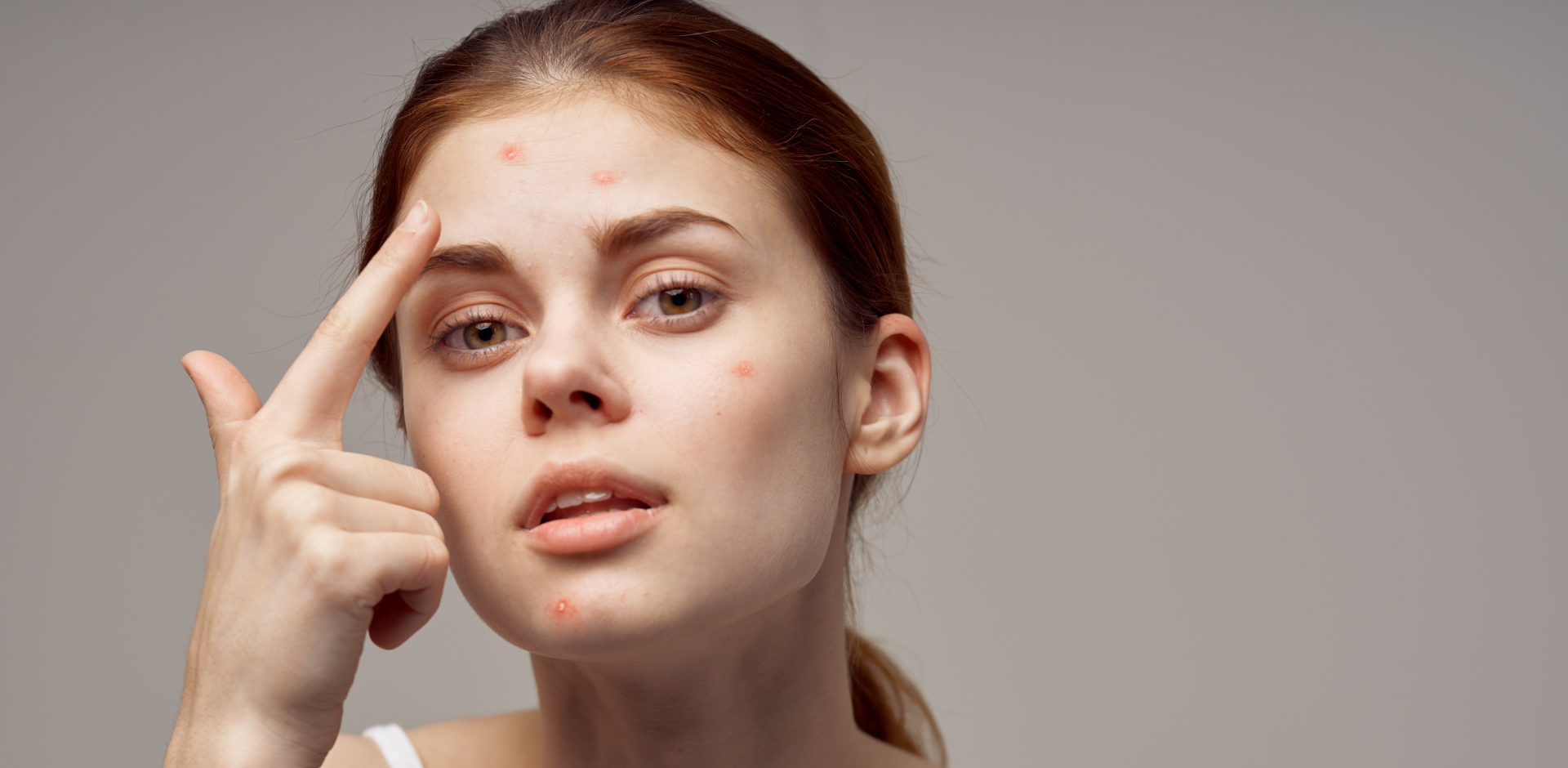 Pleť v puberte – ako si vyskladať kozmetickú rutinu pre tínedžerov