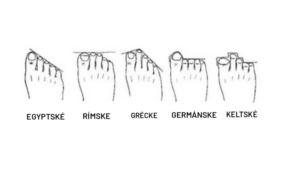 Ako si vybrať obuv podľa typu chodidla?