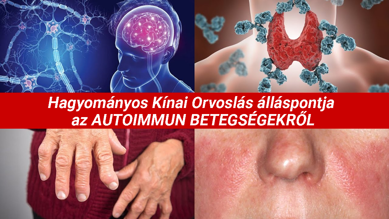 A HKO (Hagyományos Kínai Orvoslás) álláspontja az autoimmunitásról és a gyógygombákról