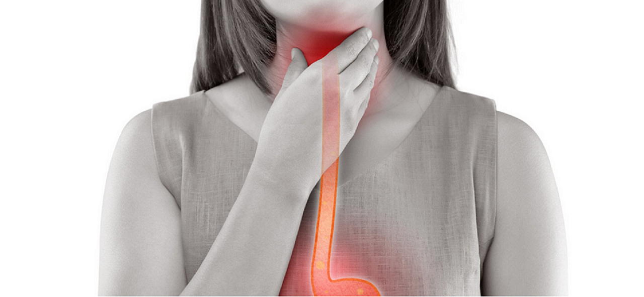Co je reflux a co na něj pomáhá? Přírodní doplňky, bylinky i domácí tipy