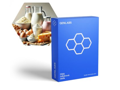 Laktozove intolerance